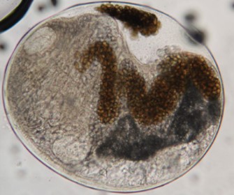 Images of encysted, self-fertilized, and gravid adults of Alloglossidium progeneticum from a crayfish host 